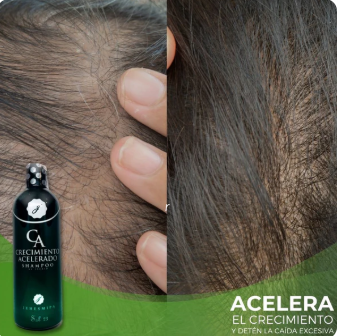 Pack Crecimiento Capilar 3X: Ouhoe Capilar + Crema Minoxidil + Shampoo Turbo Crece