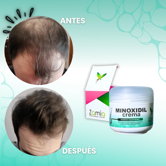 Pack Crecimiento Capilar 3X: Ouhoe Capilar + Crema Minoxidil + Shampoo Turbo Crece