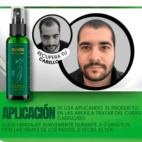 Pack Crecimiento Capilar 3X: Ouhoe Capilar + Crema Minoxidil + Shampoo Turbo Crece